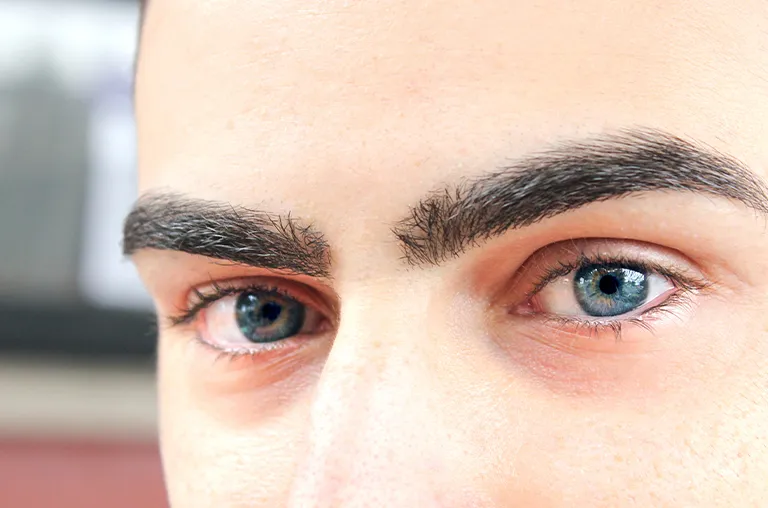 Kuntur Clinic clinica capilar especialista en microinjertos de cejas masculinas en la provincia de Barcelona