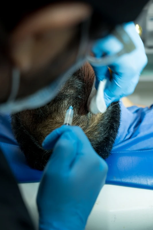 Doctor de la clinica estetica Kuntur Clinic especializado en mesoterapia con PRP para frenar la caida de pelo en hombres en la provincia de Barcelona