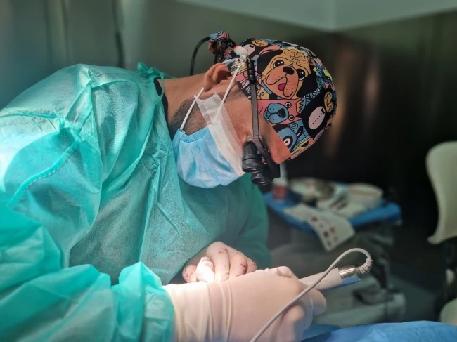 Cirujano capilar de Kuntur Clinic en quirofano realizando microinjerto capilar con tecnica DHI FUE zafiro en Barcelona