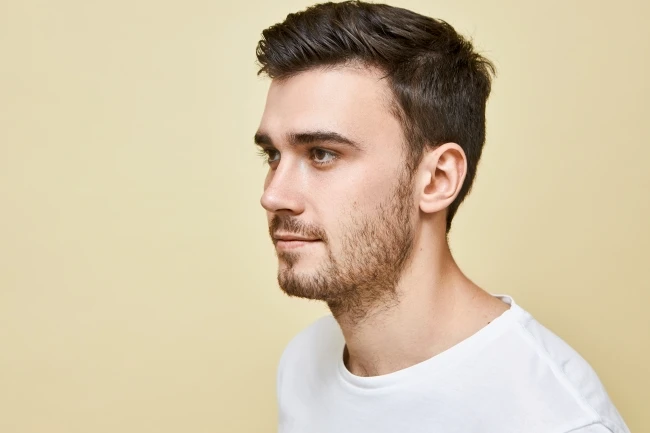 Kuntur Clinic clinica capilar experta en realizar microinjertos de barba en hombres en la ciudad de Barcelona