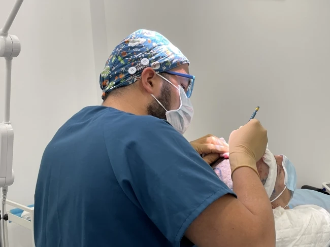 Cirujano capilar de la clinica estetica Kuntur Clinic realiza incisiones en paciente de microinjerto con tecnica DHI FUE zafiro en la ciudad de Barcelona
