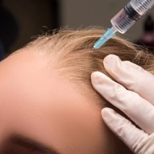 Descubre los mejores tratamientos capilares que puedes realizarte este año en Kuntur Clinic en la ciudad de Barcelona