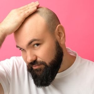 Zona donante en injerto capilar, todo lo que debes saber por Kuntur Clinic, clínica capilar de Barcelona