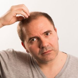 ¿Cuándo será posible realizar una clonación capilar- Todo sobre esta nueva técnica por Kuntur Clinic en la ciudad de Barcelona