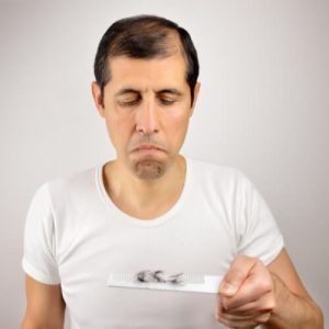 En qué consiste el efecto shedding por Kuntur Clinic, clínica capilar de Barcelona