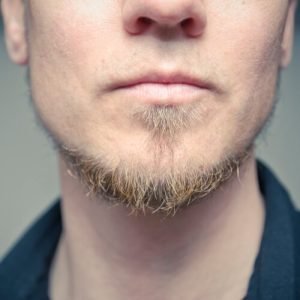 Cómo conseguir una barba poblada gracias al injerto capilar de Kuntur Clinic, centro capilar ubicado en la ciudad de Barcelona