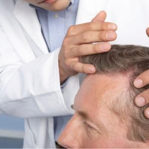 Explora la revolución del injerto capilar_ FUE vs. FUT, y por qué FUE ha ganado terreno