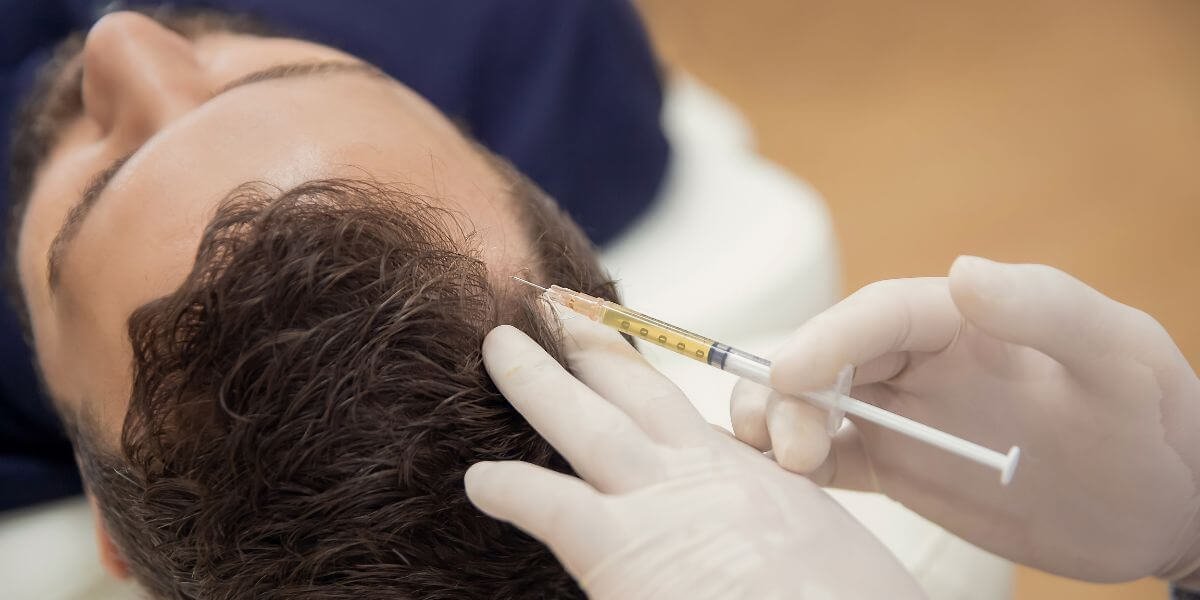 Mesoterapia capilar en Kuntur Clinic